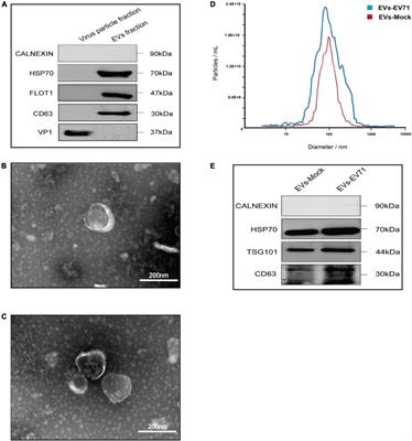 EV71 infection alters the lipid composition of human rhabdomyosarcoma (RD) cells-derived extracellular vesicles